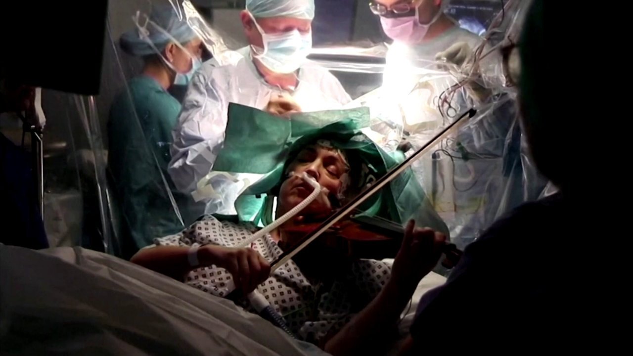 women play the violin during brain surgery