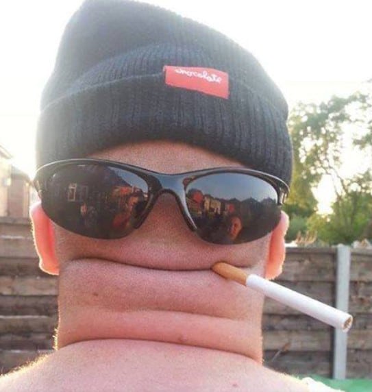 weird neck picture